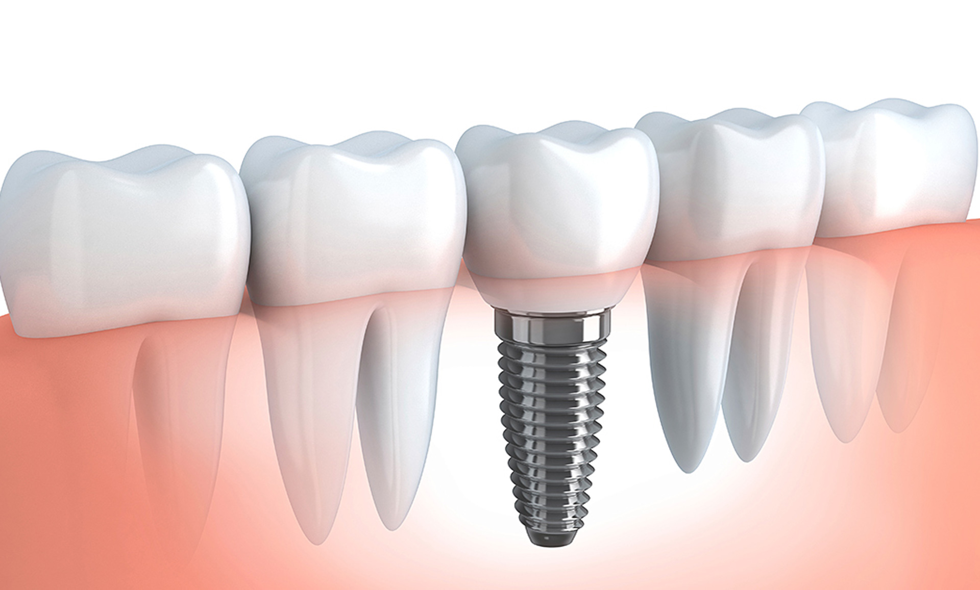 Poland is one of the most established destinations for dental tourism in Europe