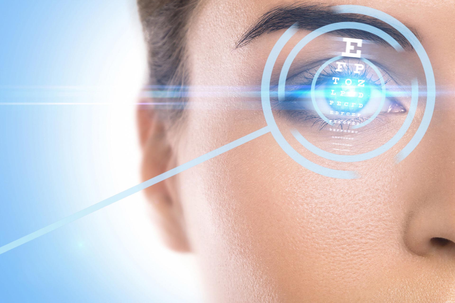 What are the side effects or complications of laser eye surgery?