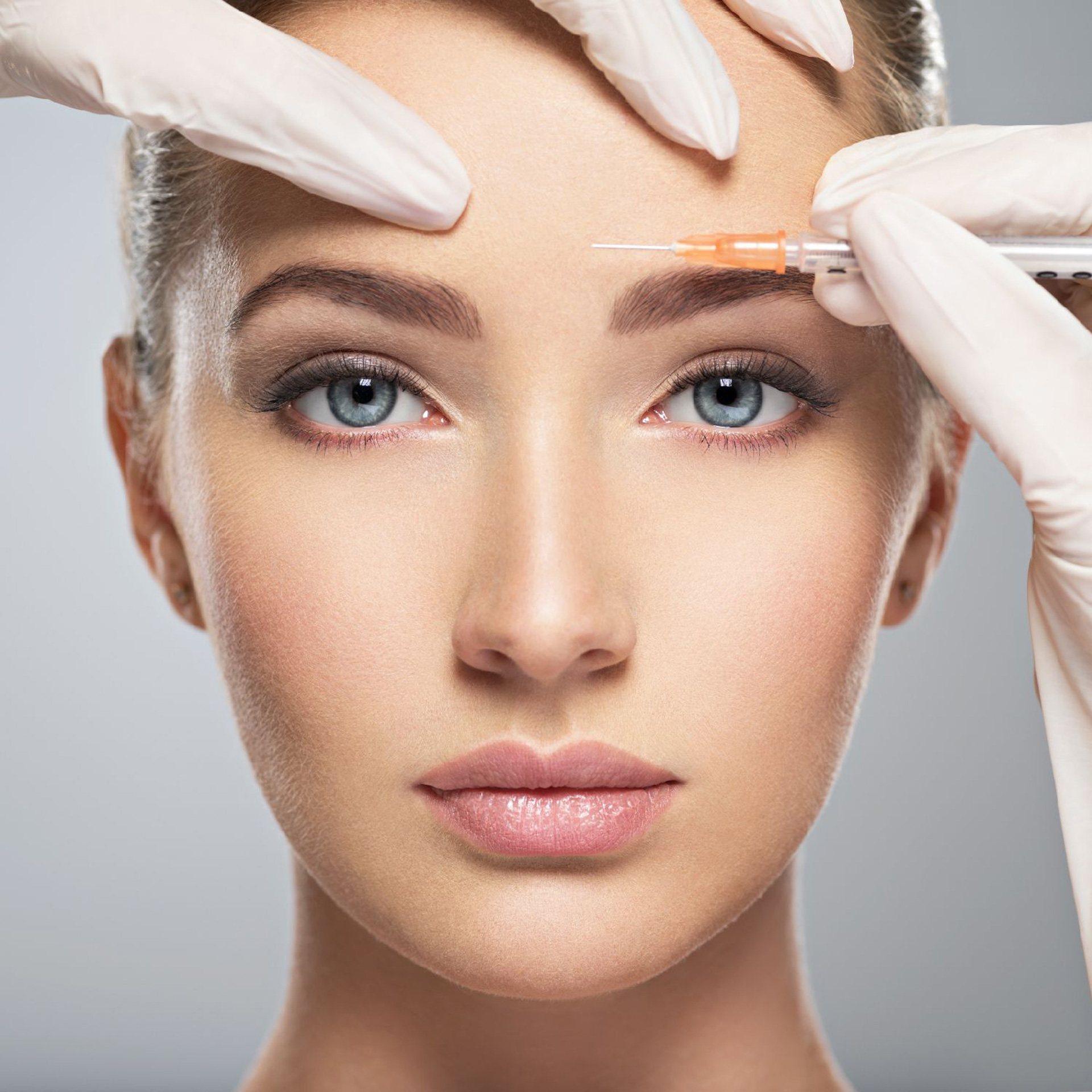 What are botox injection points and how are they determined?