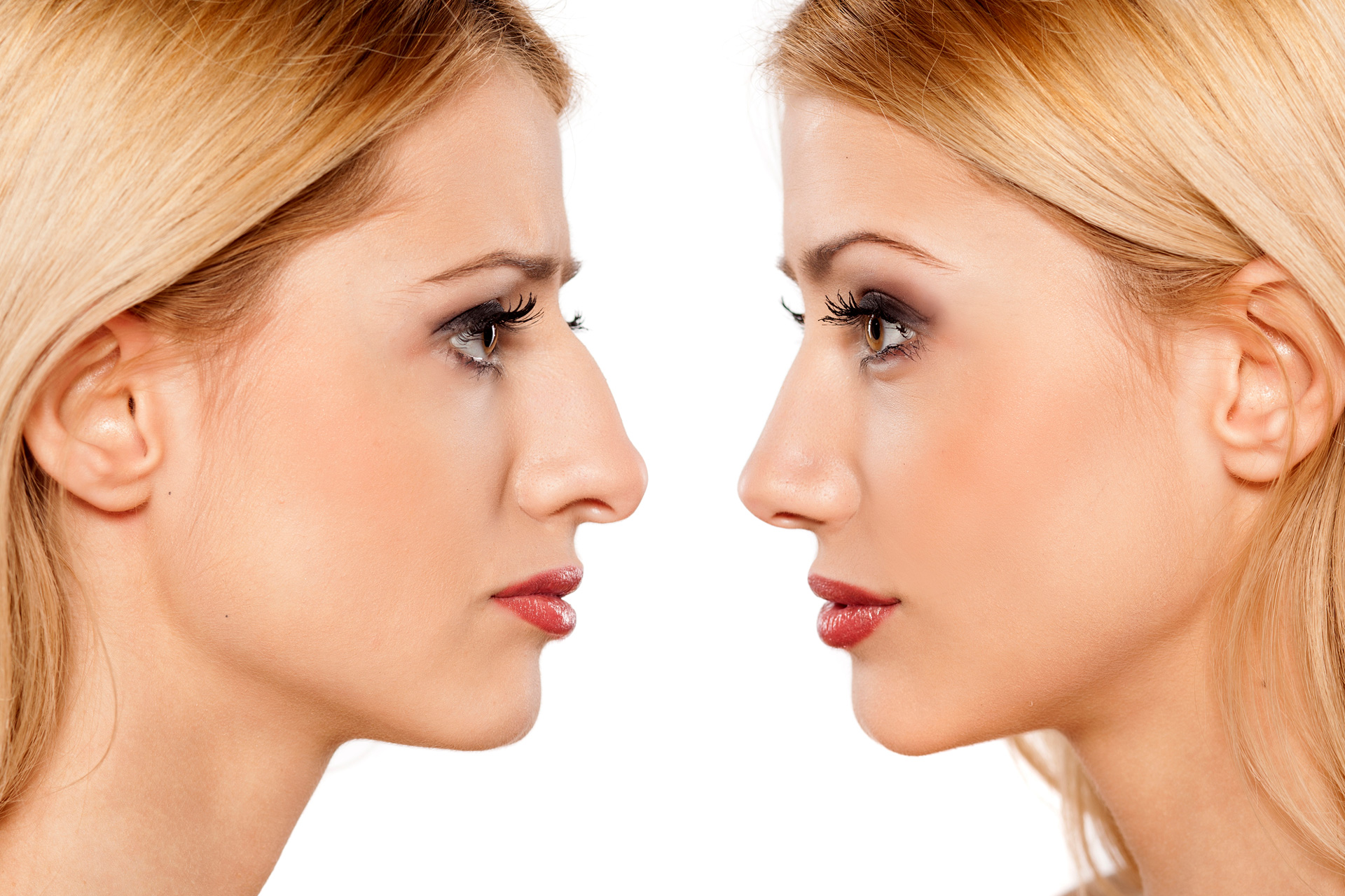 How Much Does a Nose Job Cost in Turkey?