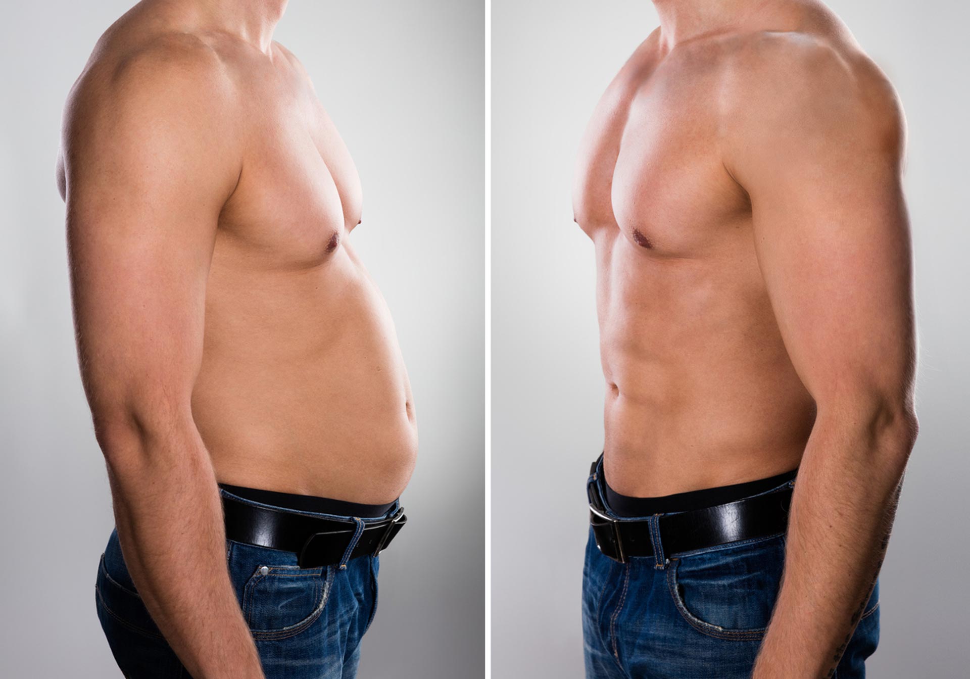 Q: How long does liposuction last for men?