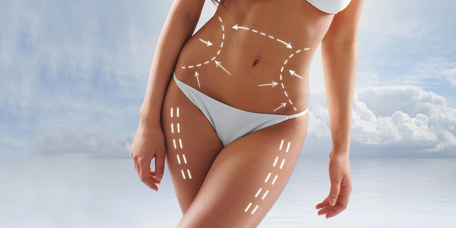 Q: Can liposuction procedures for women in Turkey be done safely and cheaply?